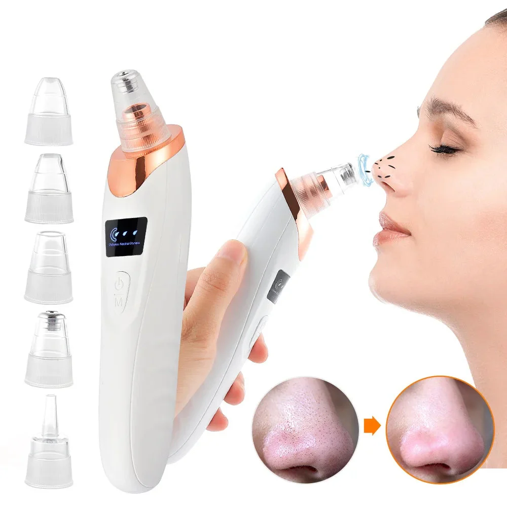 Electric Pore Remover - Image 2